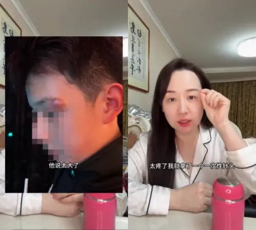 关凌用一次性针头帮儿子挑眉角痘痘的场景