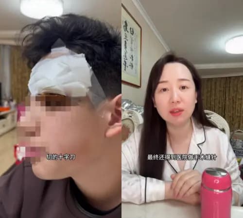 关凌儿子眉角术后缝针的伤口特写,让人心疼